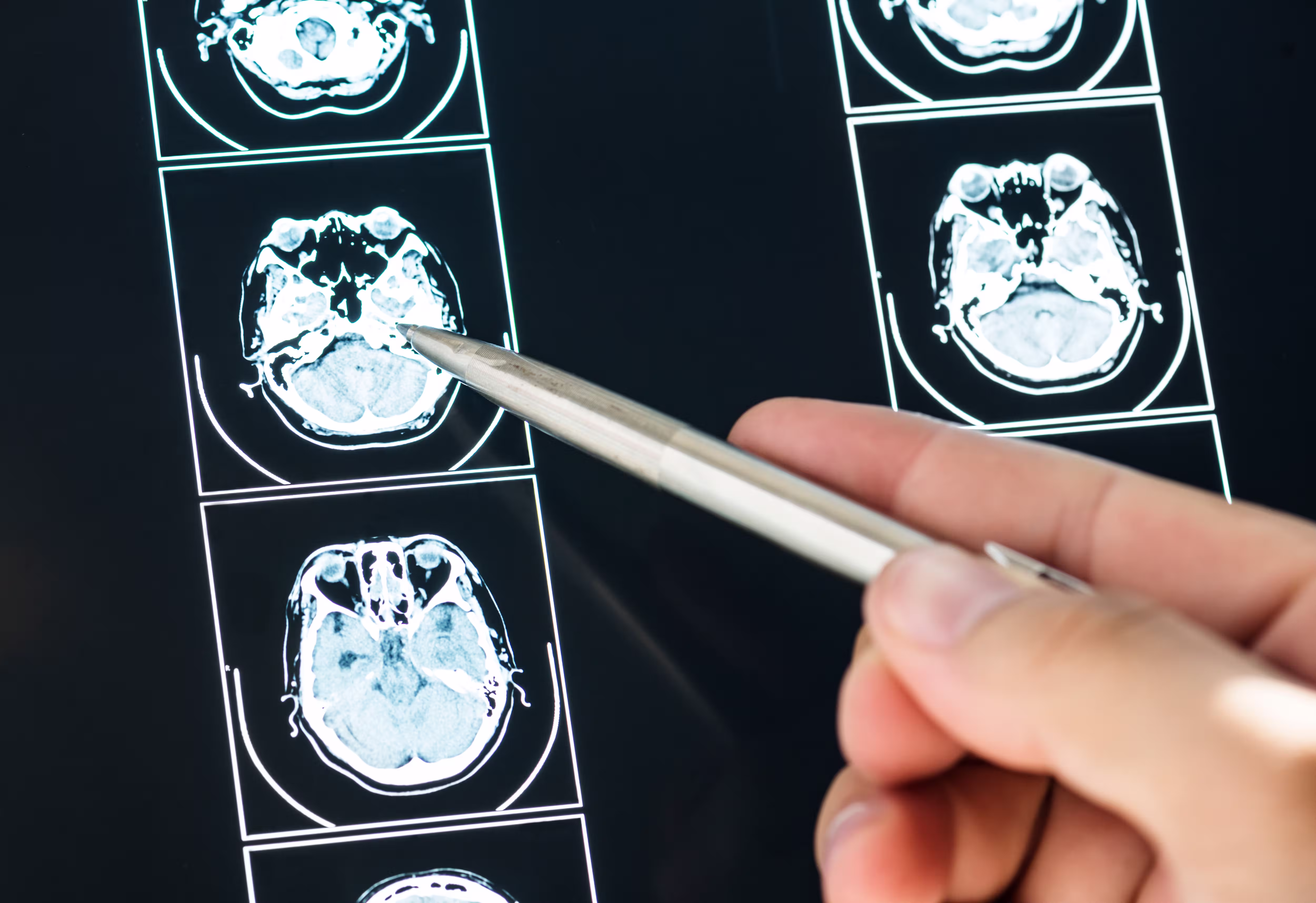 Can a Brain Have a Biological Age Different From Its Actual Age? - Main image